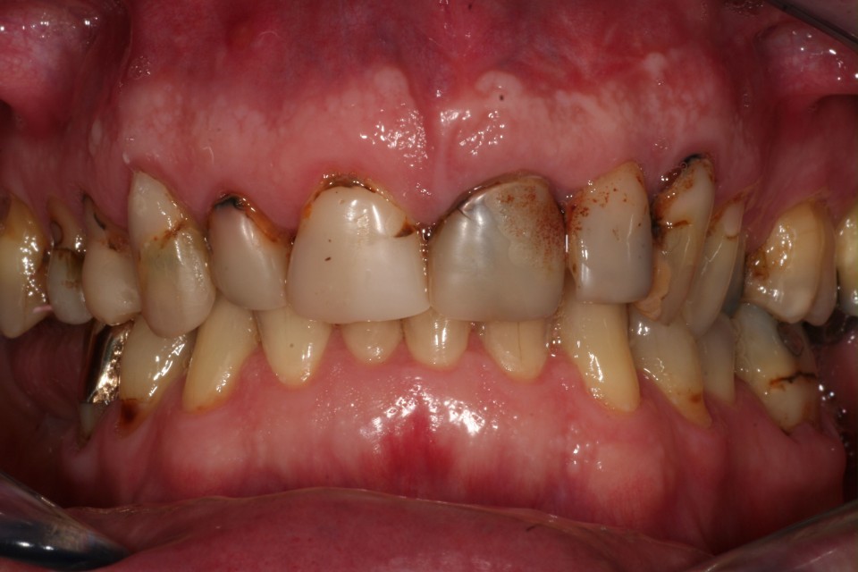 Casus 3 voor behandeling